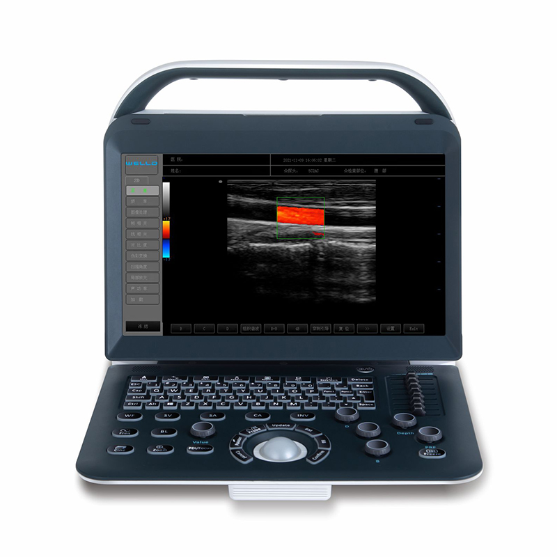  Color Doppler Ultrasound Scanner